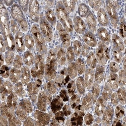 C9orf152 Antibody, Novus Biologicals:Antibodies:Primary Antibodies